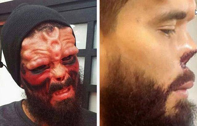 tilestwra.gr | Έκοψε τη μύτη του και έκανε τατουάζ για να μοιάζει στον Red Skull!